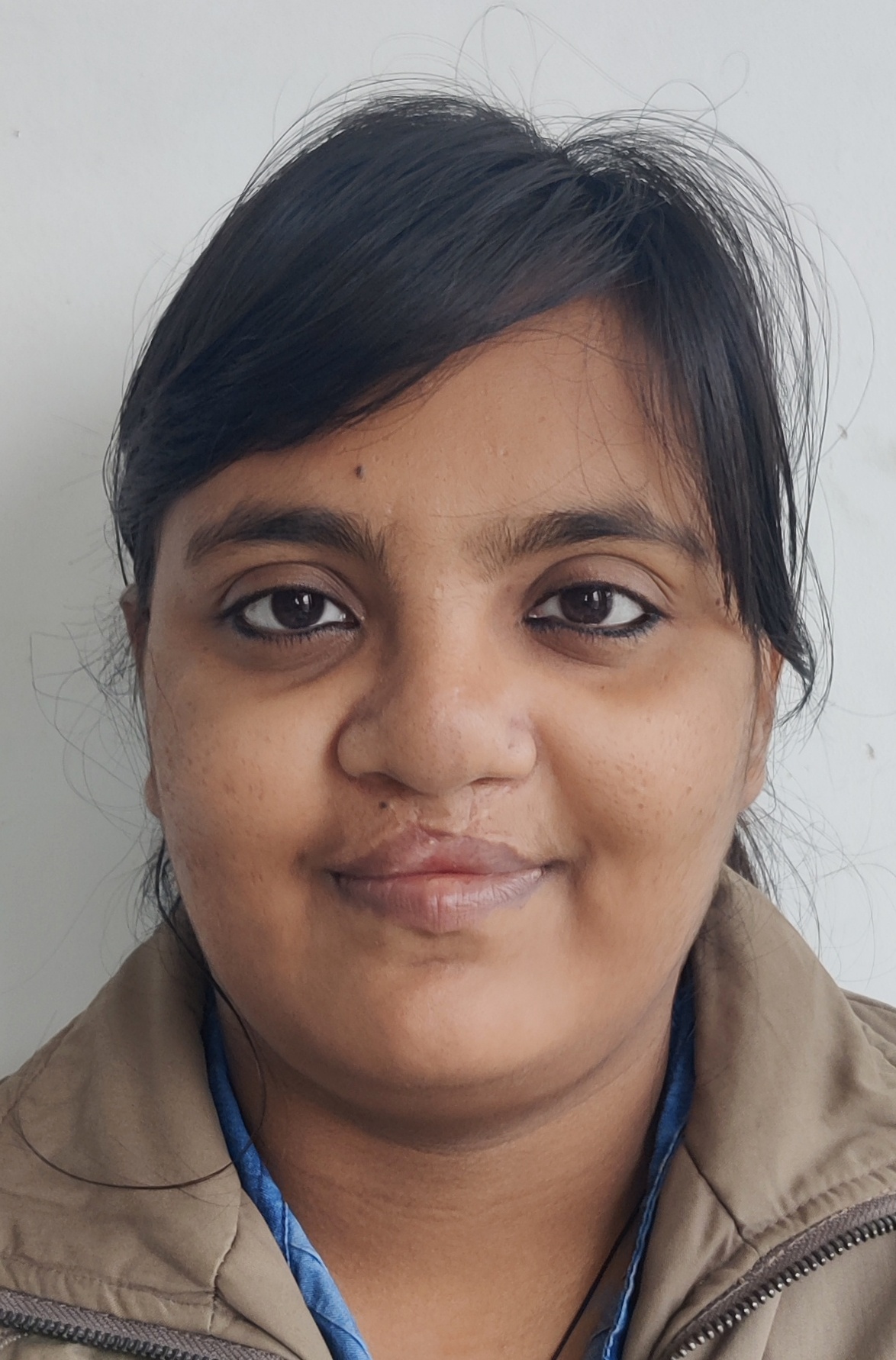 Bilateral Cleft Lip and Palate with Midface Retrusion - Before Treatment